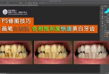PS修图技巧 利用画笔和色相饱和度工具 去除牙渍 美白牙齿(附素材)-修图师
